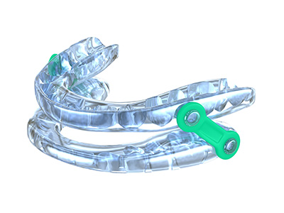 Keith A. Kye, DDS, FAGD