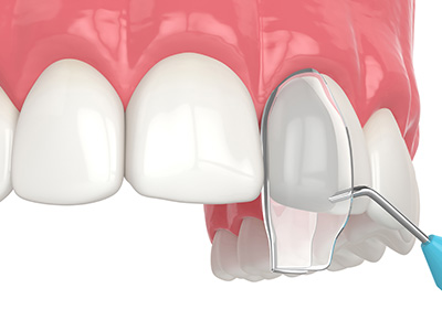 Keith A. Kye, DDS, FAGD
