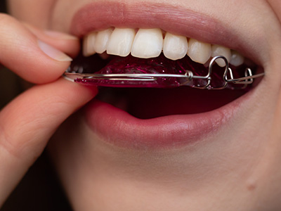 Keith A. Kye, DDS, FAGD