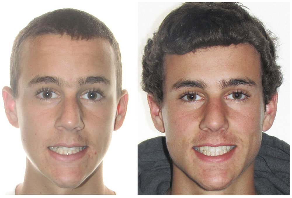 Keith A. Kye, DDS, FAGD