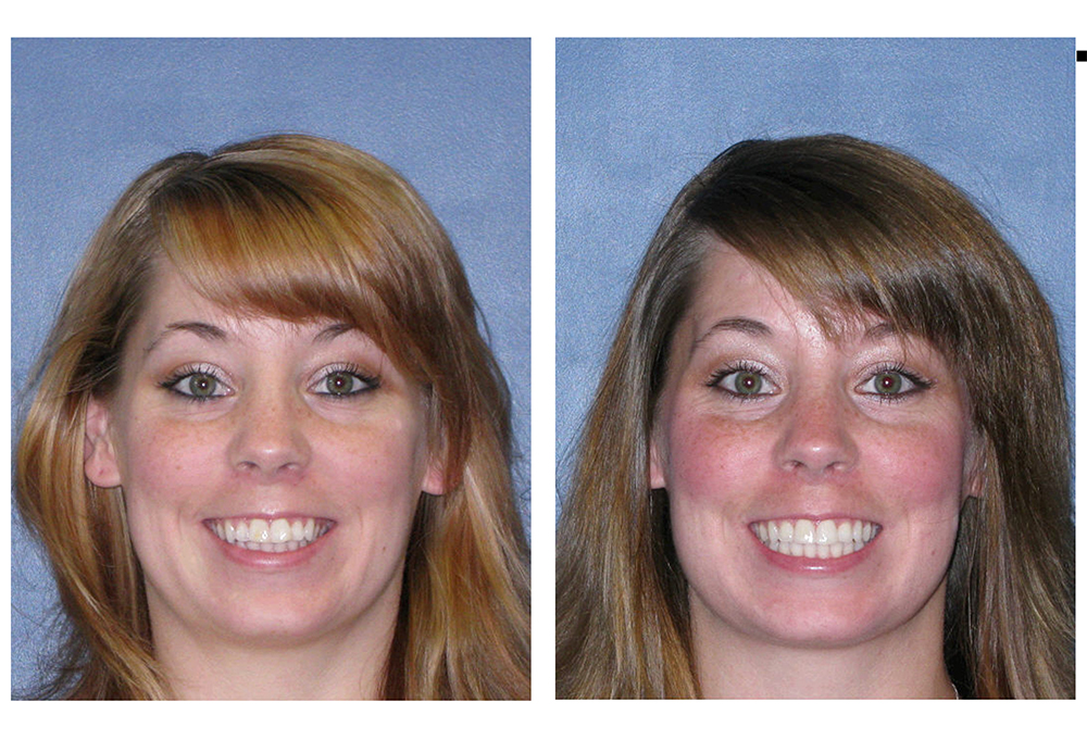 Keith A. Kye, DDS, FAGD