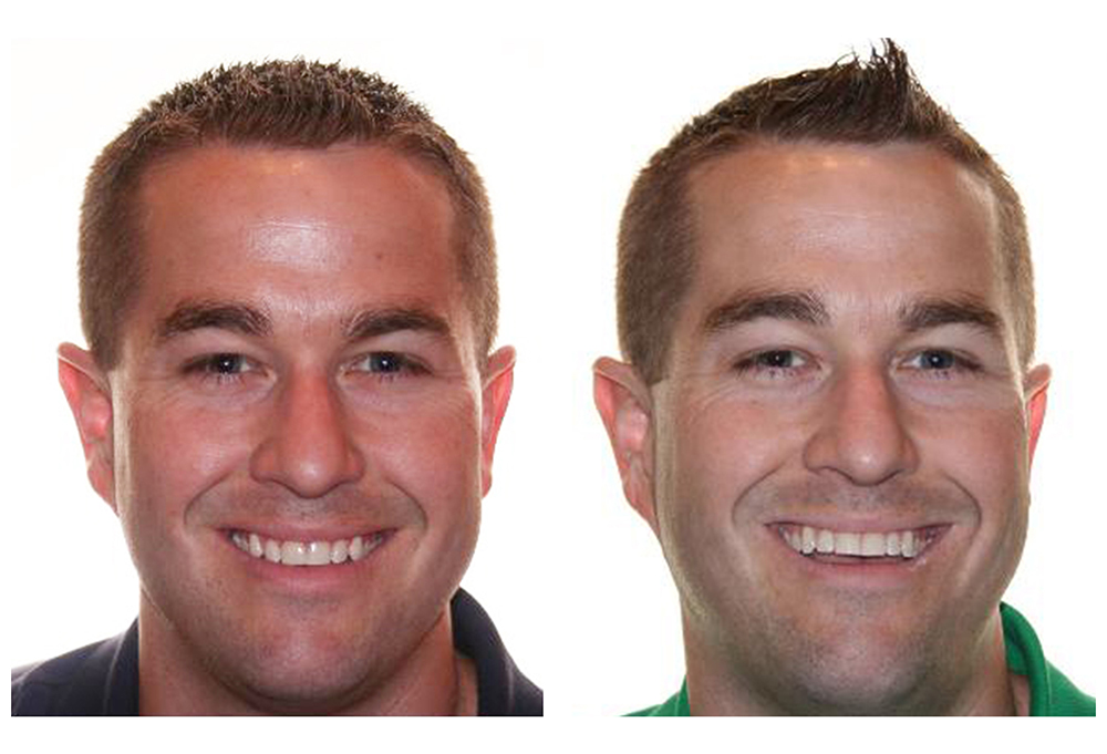 Keith A. Kye, DDS, FAGD