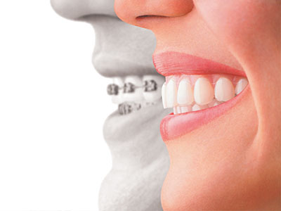 Keith A. Kye, DDS, FAGD