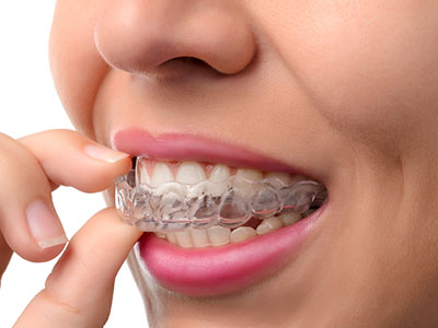 Keith A. Kye, DDS, FAGD