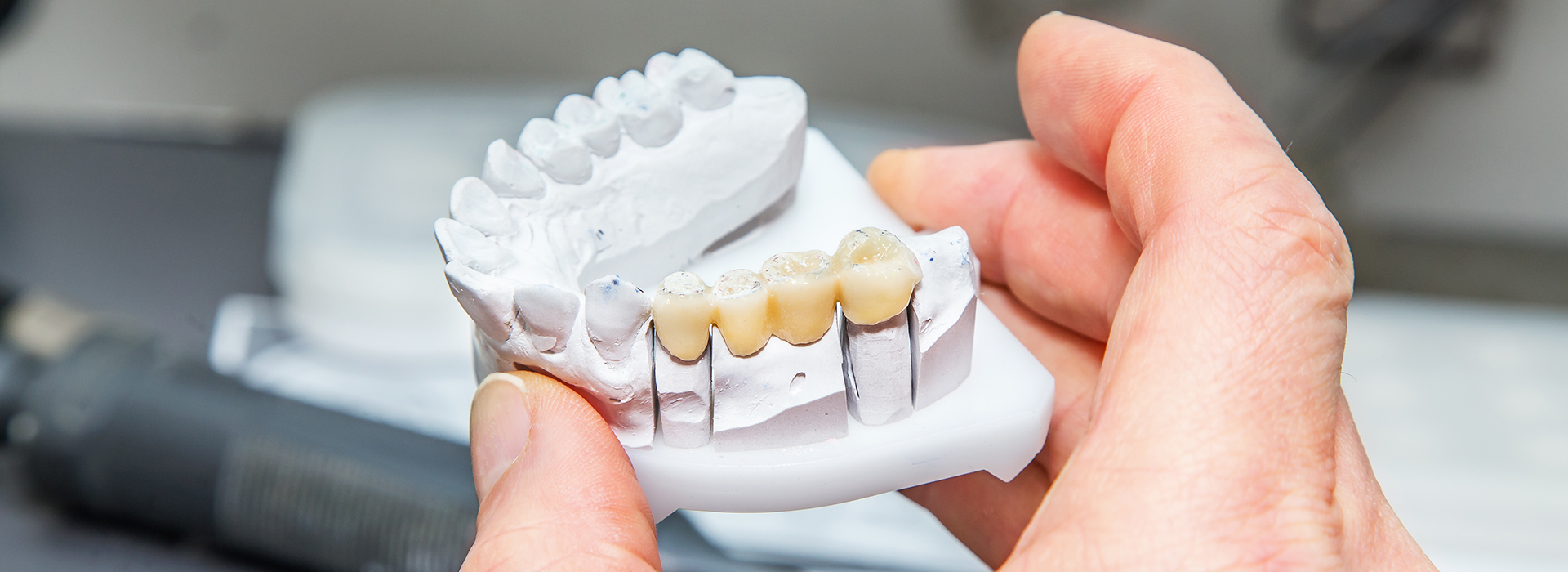 Keith A. Kye, DDS, FAGD