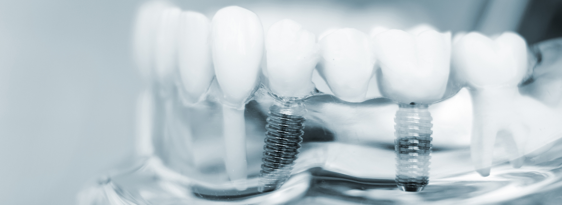 Keith A. Kye, DDS, FAGD