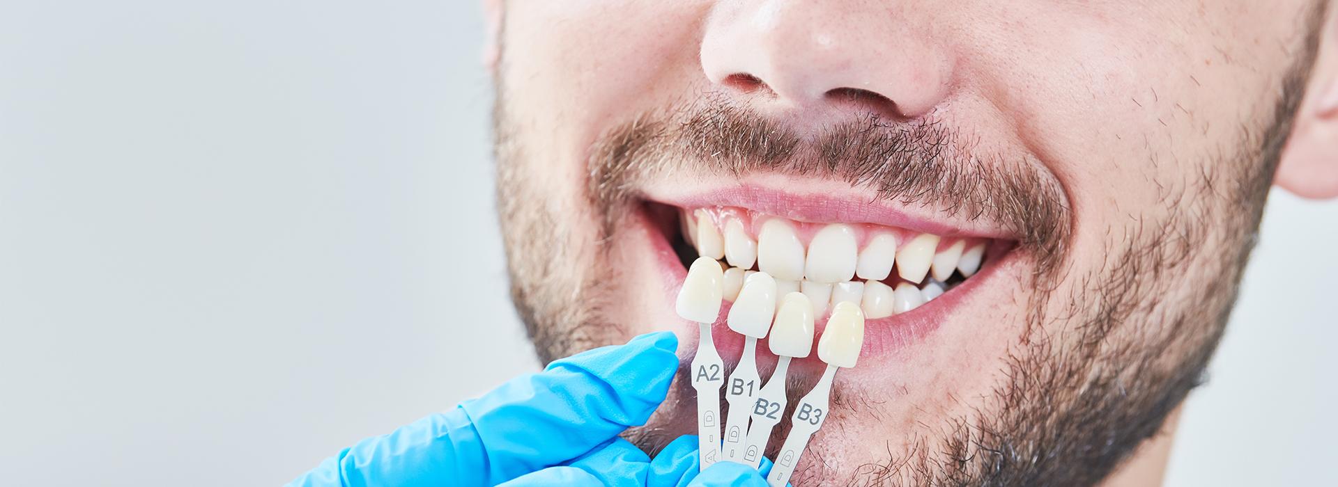 Keith A. Kye, DDS, FAGD