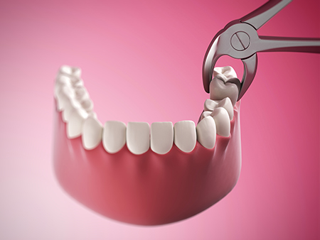Keith A. Kye, DDS, FAGD