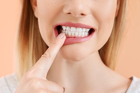 Keith A. Kye, DDS, FAGD